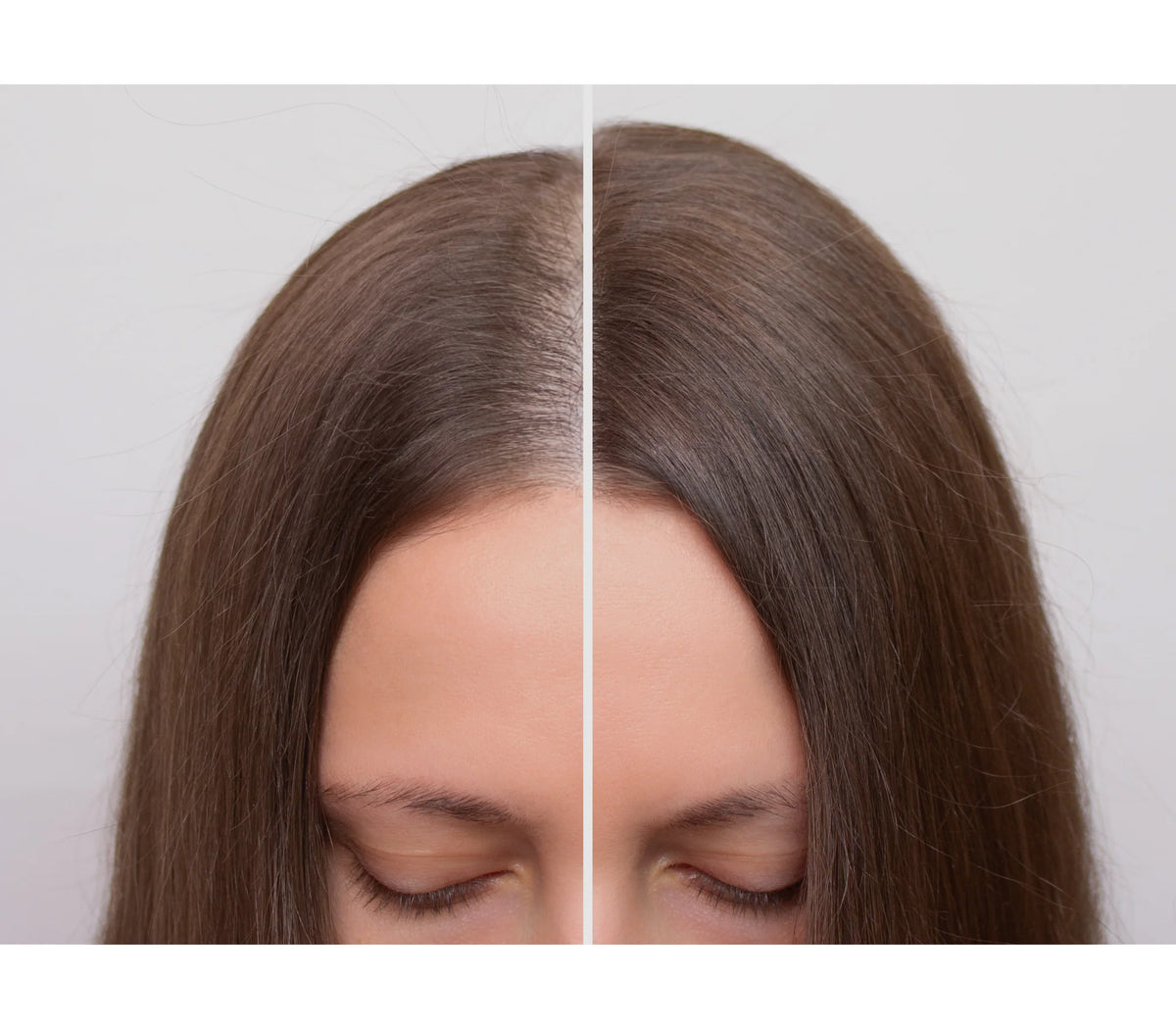 Farmagan Bioactive Hair Treatment Action Sh Anti-Loss Adjuvant Shampoo 1000ml Shampoo/Conditioner Farmagan Bioactive